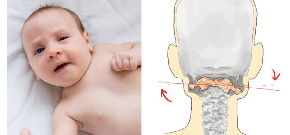 Czym jest syndrom KISS i dlaczego młodzi rodzice powinni przeczytać kilka zdań na jego temat?