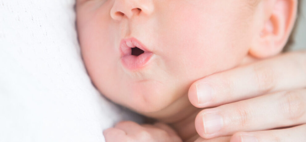 „Moje dziecko ma napięcie mięśniowe”